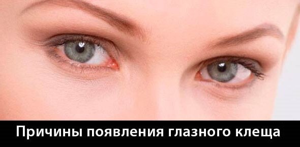 Лечение демодекоза Лечение демодекоза