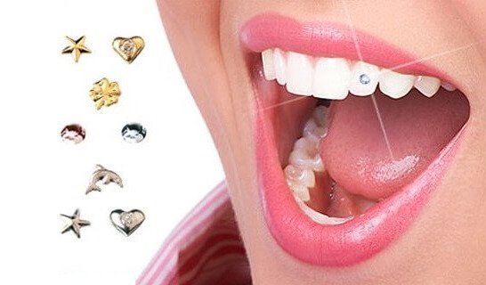 Скайсы на зубы для ослепительной улыбки 